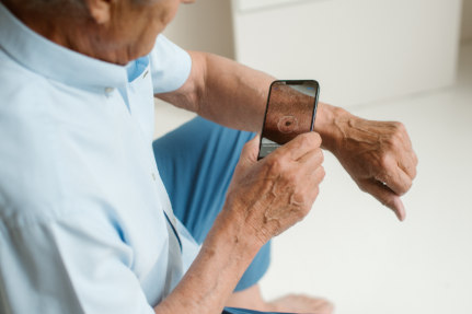 Man taking an image of his skin