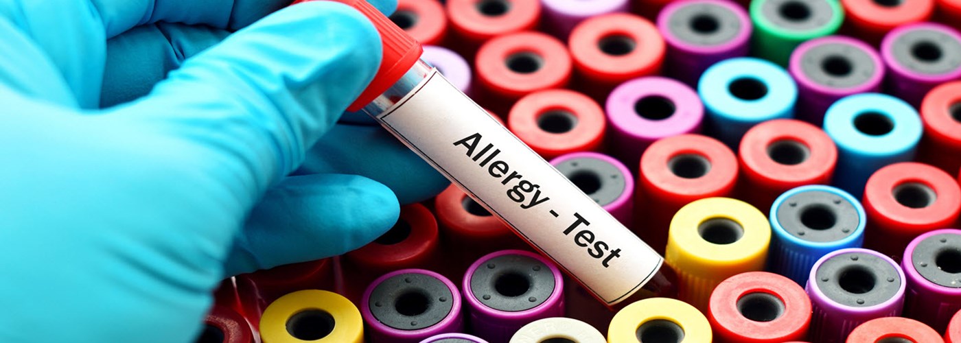 Testing for allergies