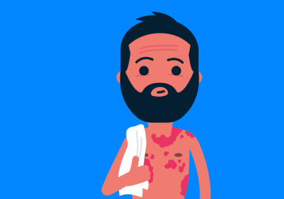 man with psoriasis on his torso man with psoriasis on his torso